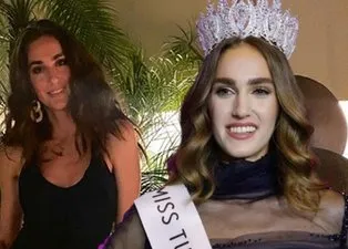 Miss Turkey birincisi İdil Bilgen sessizliğini bozdu