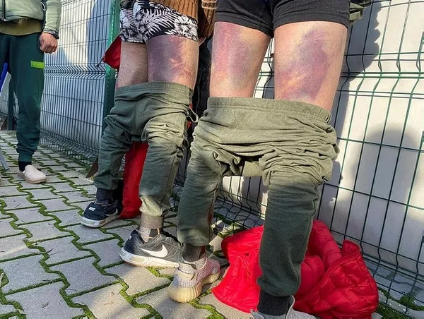 Yunan zulmünden Türk jandarması kurtardı! Mehmetçik olmasaydı 40’ımız da donacaktık