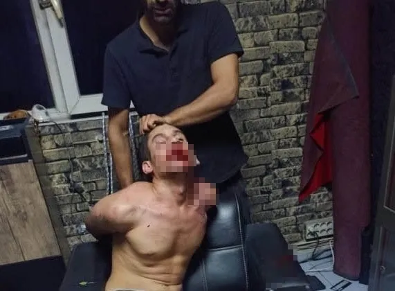 1721134265988.jpg Kerpetenle dişlerini söküp hamamböceği yedirdiler! Antalya'da kan donduran işkence: 4 yıldır kabuslarla uyanıyor - 3