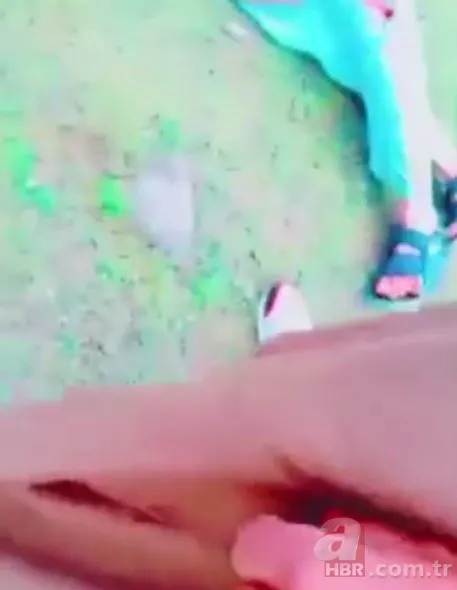 TikTok'taki meydan okuma hastanede bitti! Kendisini yaktı 19