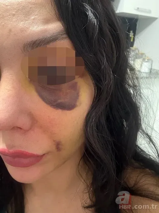 Lisanlı kick boksçudan iş arkadaşına kıskançlık dayağı! 6