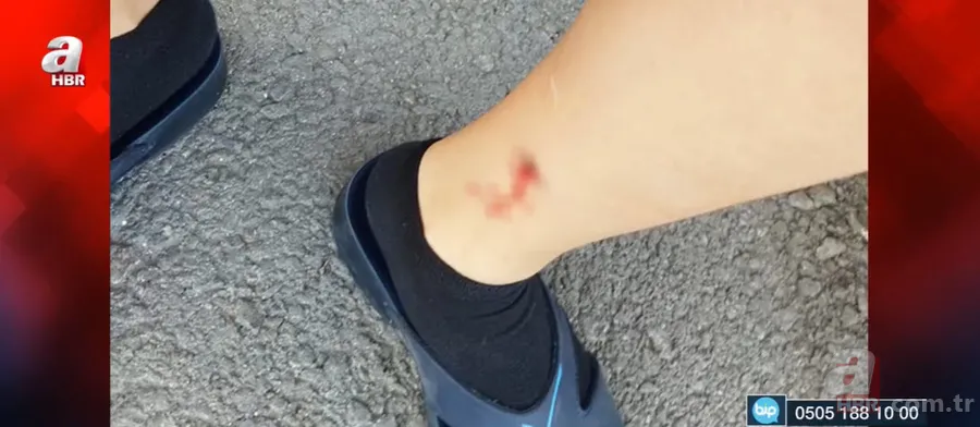 İzmir'de sokak köpekleri çocuğa saldırdı! O anlar kamerada 5