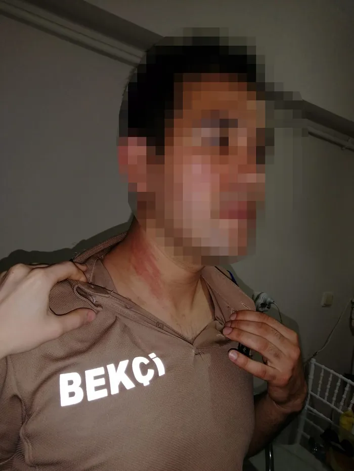 İYİ Parti’li Yetkin Öztürk’ün yalanı ortaya çıktı! Bekçinin boğazına saldırılmış...