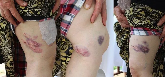Yaşlı kadın çeşmeden su doldurup evine dönerken dehşeti yaşadı: Üzerime hücum edip kıyafetimi yırttılar