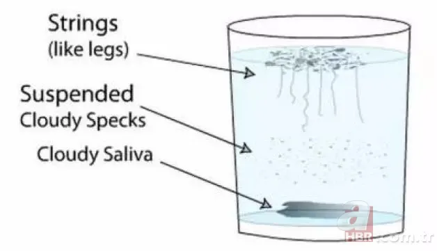 Sabah bir bardak suya tükürün! Tükürüğünüz suyun yüzeyinde kalmıyorsa… 4