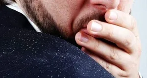 Kepek kabusuna doğal çözüm!