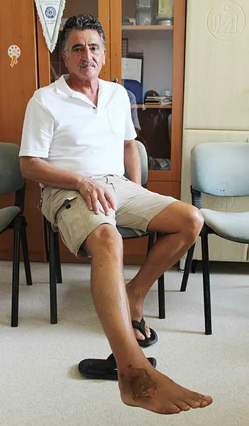 Antalya'da korkunç olay! Ayağına düşen 'aslan balığı' öldürüyordu - 5