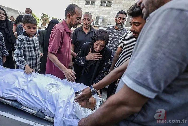 ABD'li doktor soykırımcı İsrail'in acımasızlığını herkese duyurdu: Karnından ve göğsünden vurulmuş çocuklar gördüm 4