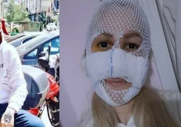 Kız arkadaşının yüzüne kimyasal madde atmıştı! İşte cani sevgili için istenen ceza