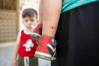 Isırdığı anda beyni küçültüyor! İstanbul’da ’Aedes’ tehlikesi