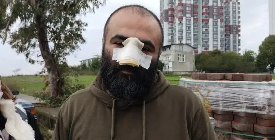 samsunda-dehset-pitbull-burnunu-kopardi-kopek-degil-sahibi-suclu-1640958749489.jpg Samsun’da dehşet! Pitbull burnunu kopardı: Köpek değil sahibi suçlu - 5