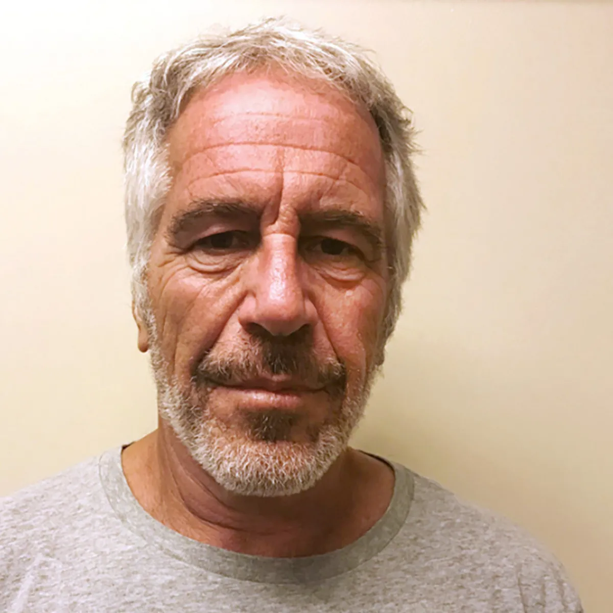 Epstein hakkında bomba iddia: Yüz nakli için gizli görüşmelerin kayıtları ortaya çıktı