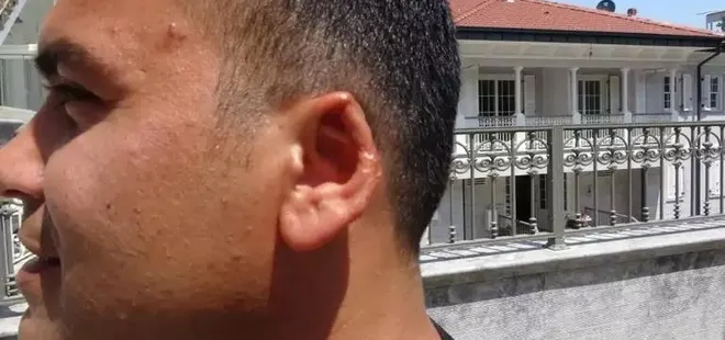Kavga esnasında kulağını ısırıp koparmıştı! Cezası belli oldu