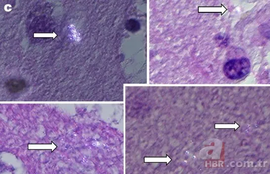 İnsan beynini bekleyen büyük tehlike! Plastikle doluyor... 3