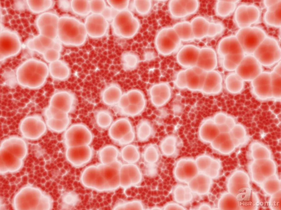 Kaçış sendromu hastalığı ne demek? Mehmet Ali Erbil hastalığı nedir? 12