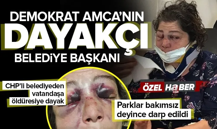 CHP'li Eynesli Belediye Başkanı Ahmet Latif Karadeniz'in adamları terör estirdi! Şikayetçi kadına öldüresiye dayak