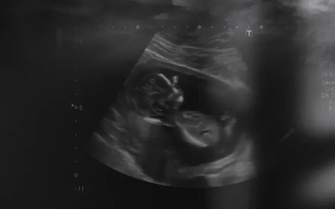 İlk gördüğünüzde ne hissettiniz?