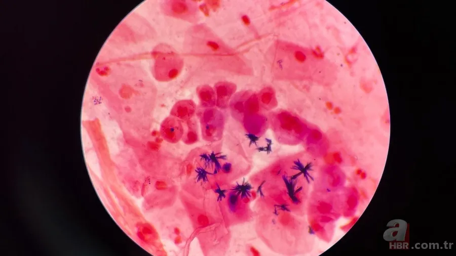 Kurban eti saklarken bu hataları yapmayın! Uzmandan önemli uyarılar: 2 saat kuralı ile hastalıklardan korunun! 3