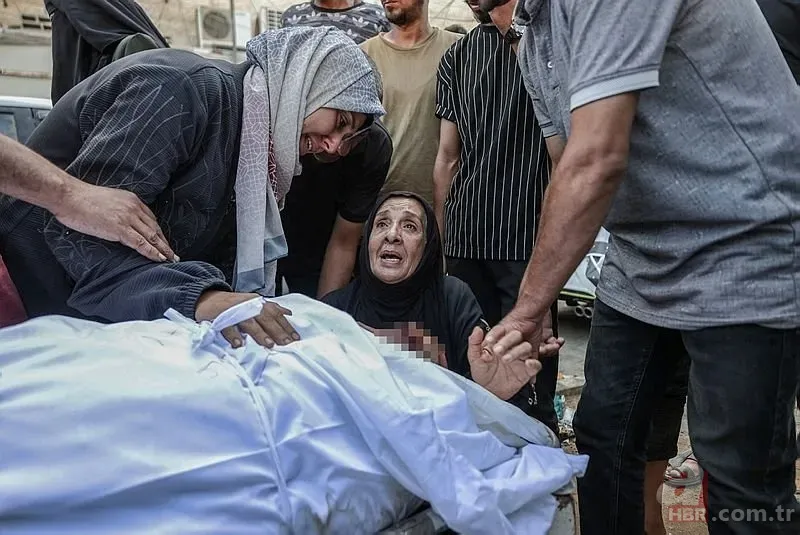 ABD'li doktor soykırımcı İsrail'in acımasızlığını herkese duyurdu: Karnından ve göğsünden vurulmuş çocuklar gördüm 3