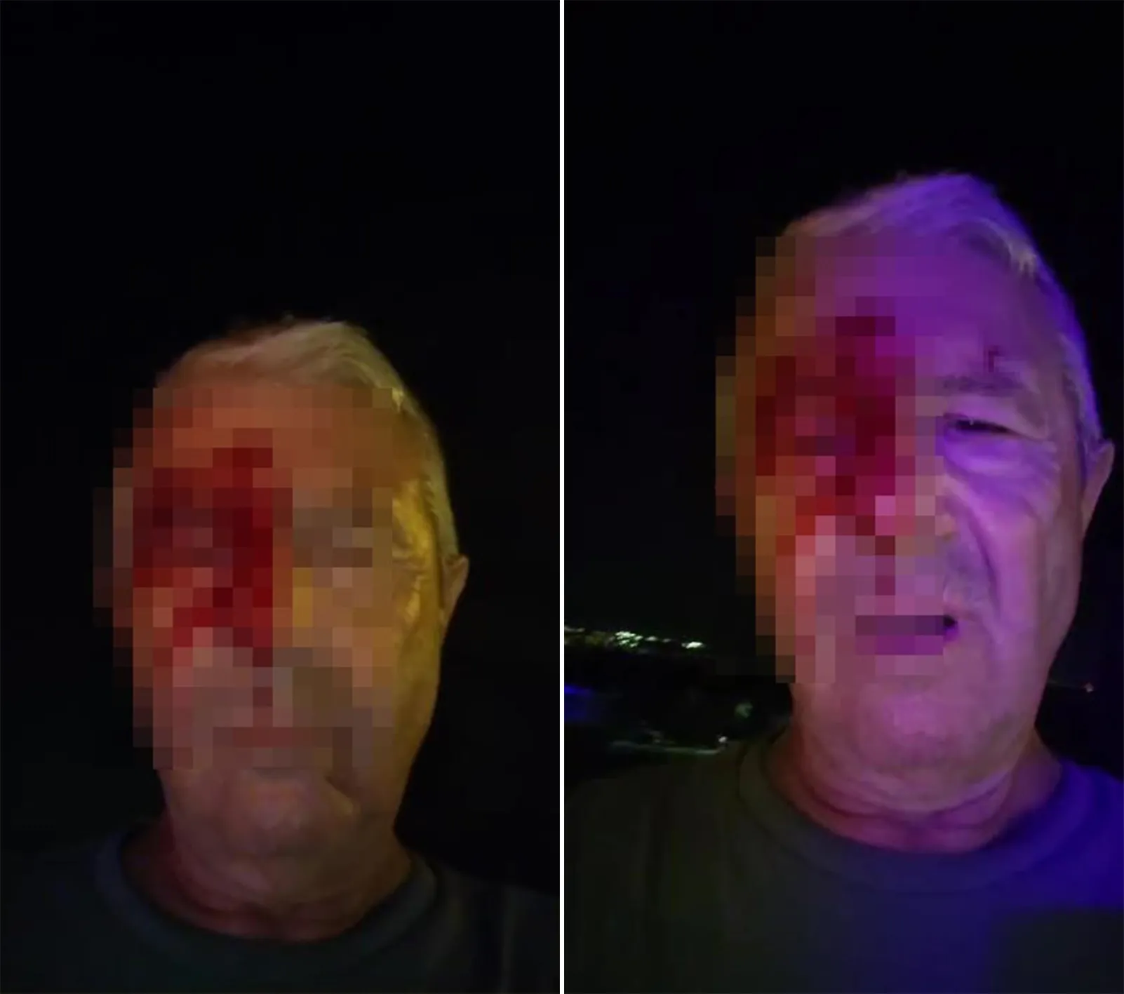 Kocaeli'de görev başındaki muhabir dehşeti yaşadı! Haber yaparken saldırıya uğradı!