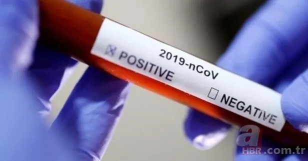 Yahudi ailesi Rockefeller koronavirüsü (corona virüs - Covid-19) 10 yıl önce böyle açıklamış 3