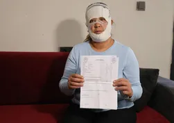 Güzelleşmek uğruna gittiği merkezde yüzü yandı: "2 yaşındaki oğlum benden korkuyor"
