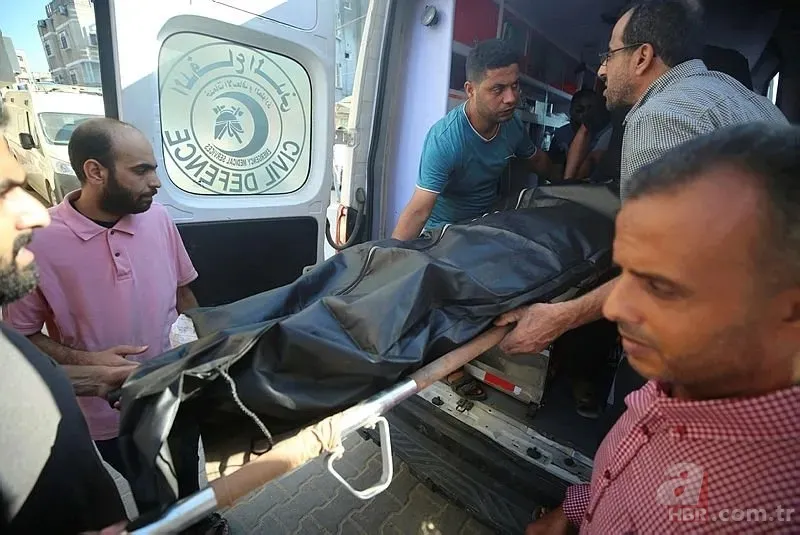 ABD'li doktor soykırımcı İsrail'in acımasızlığını herkese duyurdu: Karnından ve göğsünden vurulmuş çocuklar gördüm 15