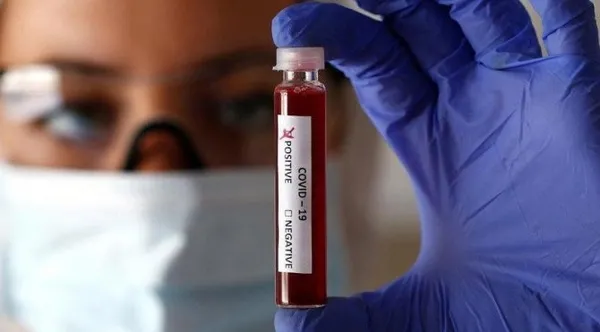 1617726086483.jpg Kan grubu ile koronavirüs arasında bağlantı var mı? 100 bin kişilik büyük deney sonuçlandı - 1