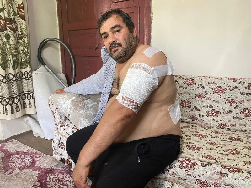 Bartın'da ayı saldırısı! 65 dikiş atıldı: Öldüğümü sanıp bıraktı 10