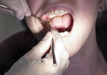 Sigara her nefeste dişleri içten çürütüyor