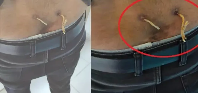 Beline delik açıp çamaşır ipi geçirdiler! Akılalmaz yöntem