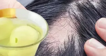 Dökülen saçları yeniden çıkarıyor! Sırrı soğan suyunda saklı...