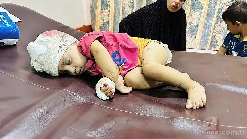 ABD'li doktor soykırımcı İsrail'in acımasızlığını herkese duyurdu: Karnından ve göğsünden vurulmuş çocuklar gördüm 14