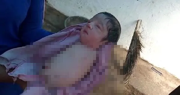 Hindistan'da kolları ve bacakları olmadan doğan bebek doktorları şoke etti - 1