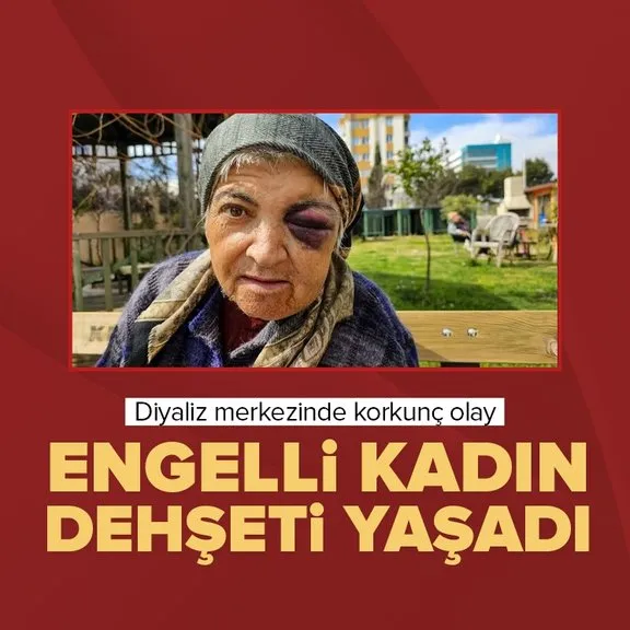 Antalya’da diyaliz merkezinde dehşet! Engelli kadın saldırıya uğradı | Gözleri morardı