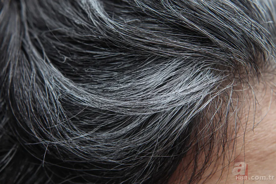 Yaşlılık belirtisi sanıyorduk! Saçtaki tek beyaz tel: Görünmez bir düşmanı durduruyormuş 6
