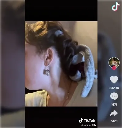 saskina-ceviren-olay-agri-kesici-diye-airpod-yuttu-1637567184263.jpg Şaşkına çeviren olay! Ağrı kesici diye AirPod yuttu - 4