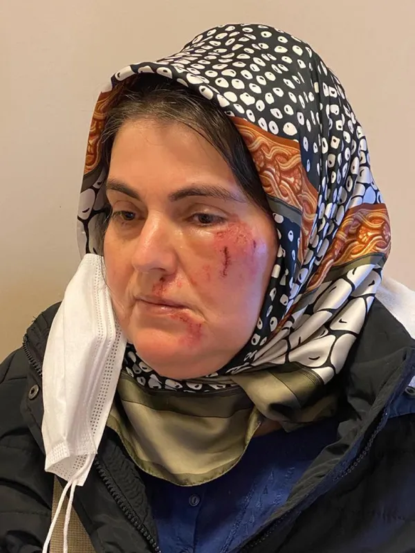 Yolda yürürken tanımadığı kişi tarafından darp edildi: İnsanlar tutmasa beni öldürebilirdi - 2