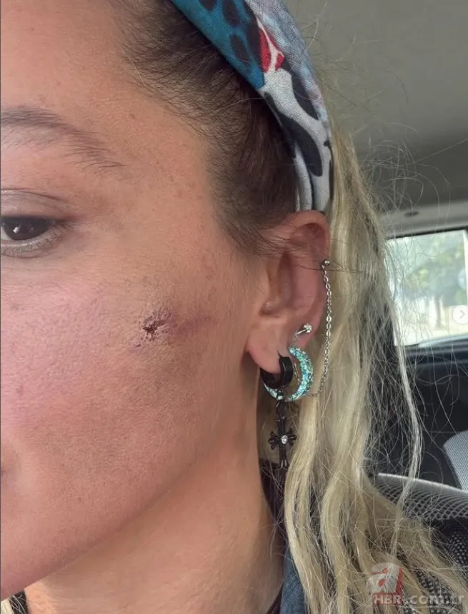 Yıldız Asyalı'nın eşinden açıklama geldi! "Kocam beni darp etti" demişti... 6