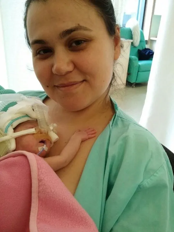 Kuvözden hayata ömürlük hayat bağı! Cesur yürekleri ve küçük parmaklarıyla yaşama tutunuyorlar - 5