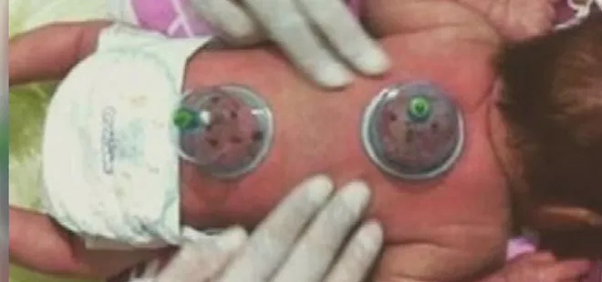 Bu görüntüler büyük tepki çekmişti! Uzmanlardan uyarı geldi