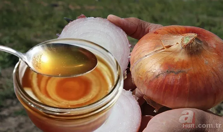 Soğan kürünün mucizevi faydası! Ünlü doktor açıkladı 1