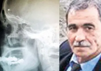 Trabzon Arsin'de akılalmaz olay!