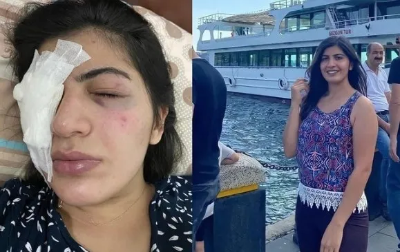 mersinde-universiteli-kizin-basina-gelenler-dehsete-dusurdu-yuzune-sivi-attilar-gozumu-acamiyorum-1668932026185.jpg Mersin’de üniversiteli kızın başına gelenler dehşete düşürdü! Yüzüne sıvı attılar: Gözümü açamıyorum - 4