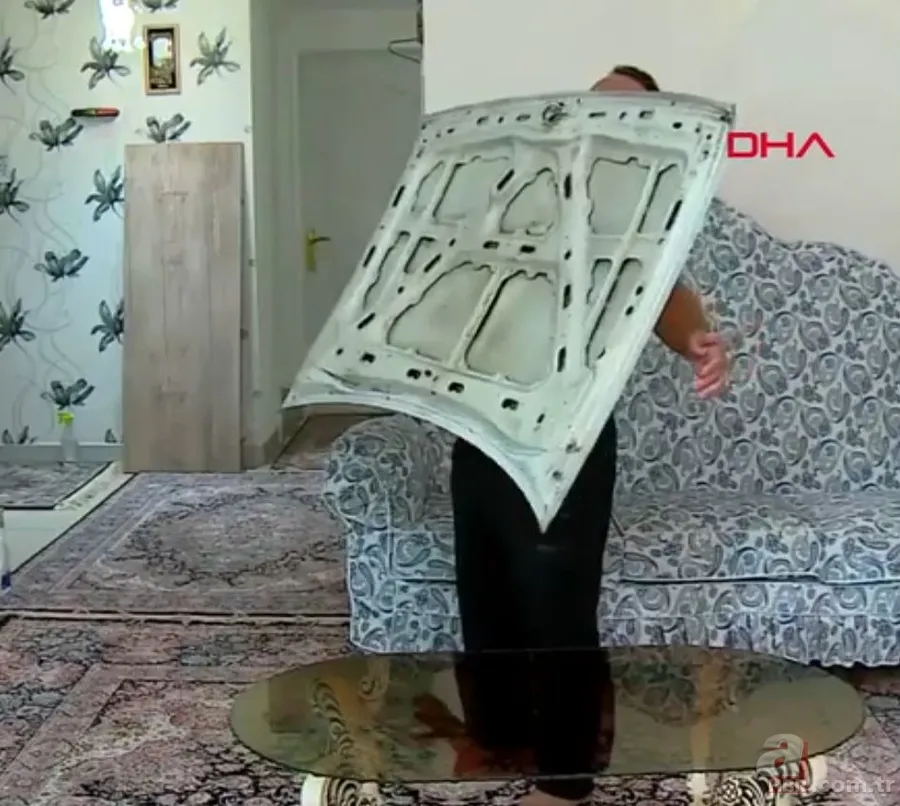 Görenler hayrete düşüyor! Ağrıları dahil her şeyi çekiyor 1