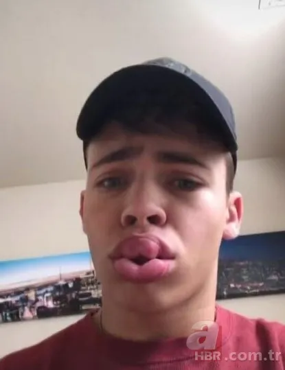 Fatih’te estetik yaptıran Bulgar modelin hayatı kabusa döndü! ‘Örümcek ağı’ operasyonu bakın ne hale getirdi? 13