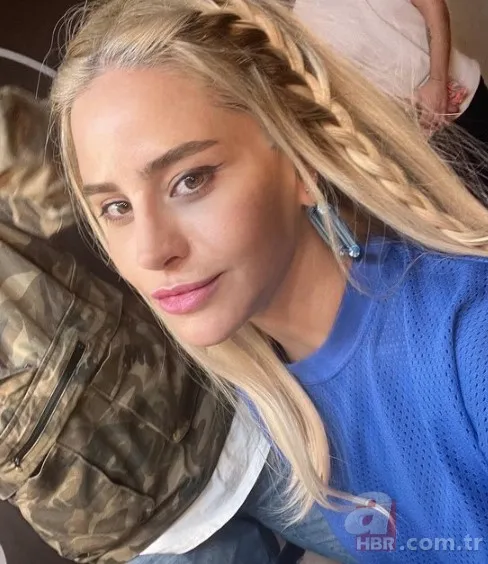 Büşra Pekin’de estetikle yeni birine dönüşenler kervanında! 1 estetiğim var deyince ti’ye alınmıştı… 4 bantla o hale gelmiş! 9