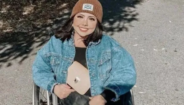 Kaybettiği yapışık ikizinin hayalini gerçekleştirdi! Hikayeleri Yürek bukrtu