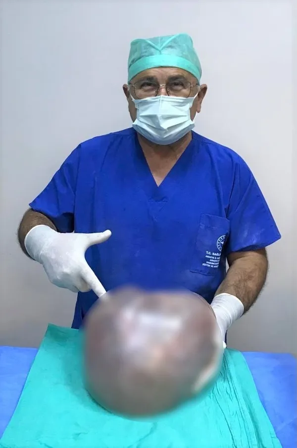 1623915844819.jpg Görenler hamile sanıyordu! Karnından 6,4 kilo kitle çıktı - 1