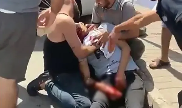 adanada-kan-donduran-goruntu-gunduz-vakti-sokak-ortasinda-kanli-infaz-1663341866636.jpg Adana’da kan donduran görüntü! Gündüz vakti sokak ortasında kanlı infaz - 1